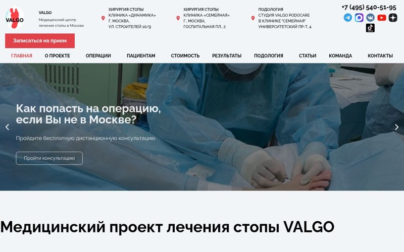 VALGO